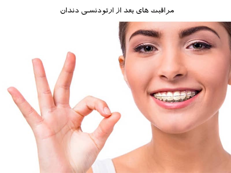 مراقبت های ارتودنسی دندان