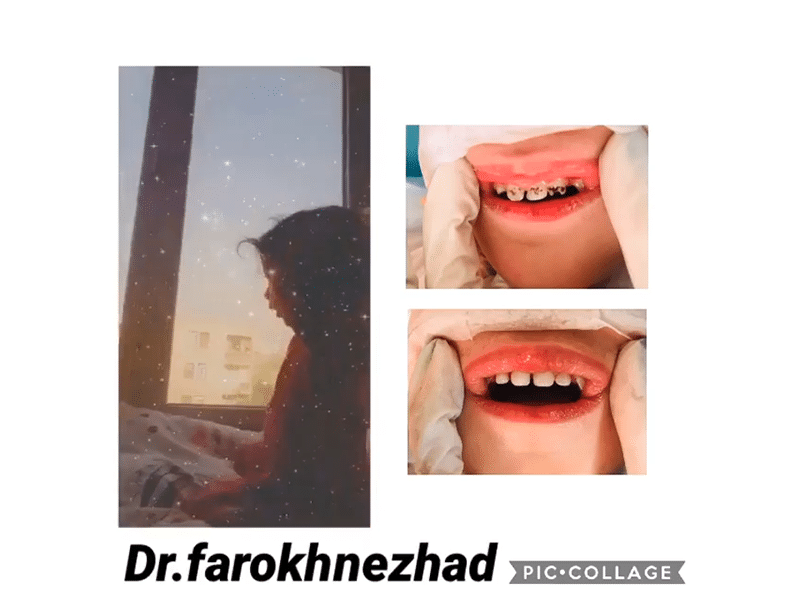 دندانپزشک اطفال