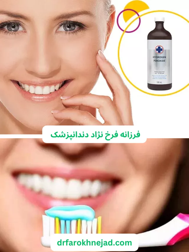 بلیچینگ دندان یا سفید کردن دندان